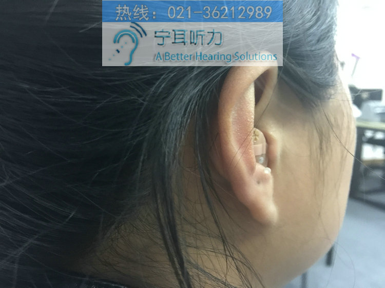 上海定制耳蜗助听器折扣店