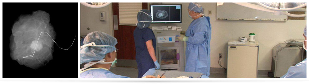 美国Faxitron乳腺外科手术标本成像系统乳腺钼靶X光机BioVision图片