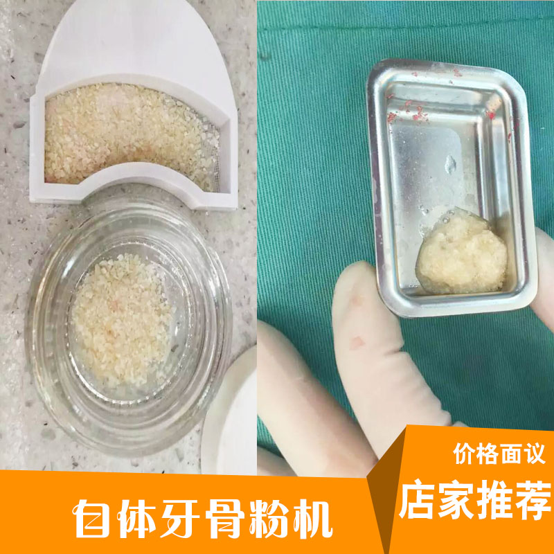 上海自体牙粉机厂家诚招代理加盟批发