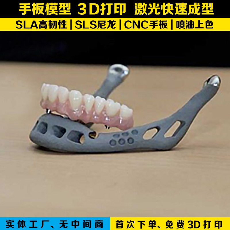 3d打印假牙模型 深圳3d手板 牙齿模型订制加工 激光固化快速成型 深圳模具配件加工制作 深圳手板模型3d打印假牙模型