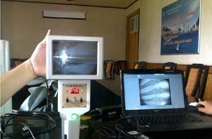 低剂量便携式X光机 便携式X光机（影像增强器） 低剂量便携式X光机（影像增强器）