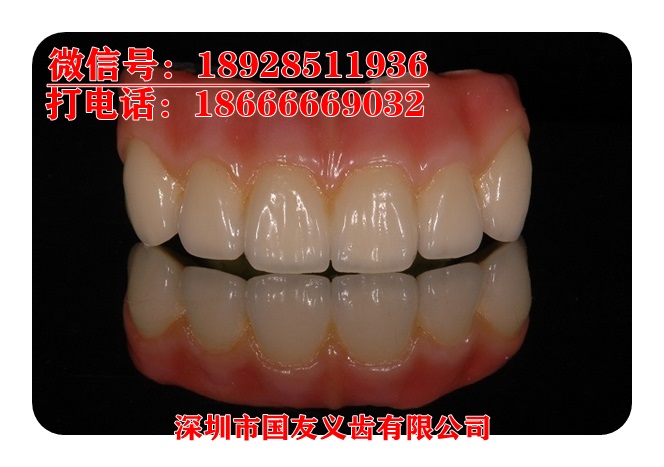 你的牙齿还好吗？德国进口威兰德授权深圳厂家直销全瓷牙价格优惠图片