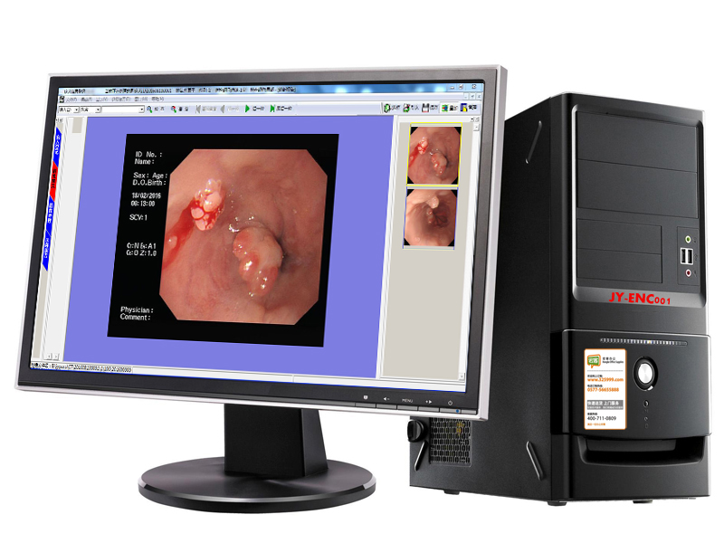 供应JY-EC01电子胃镜工作站软件电子胃镜内镜工作站