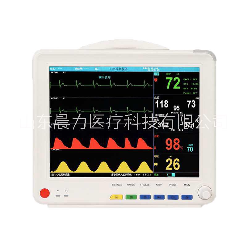医用彩色液晶TFT显示心电监护仪