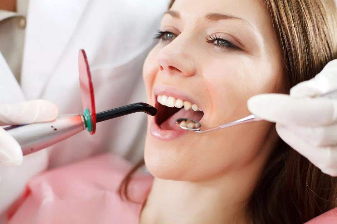 如何清除牙齿内侧的牙垢 清楚牙垢 牙贴面美白