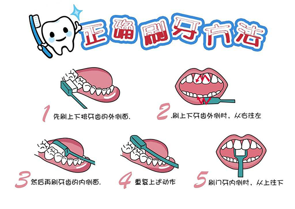 如何清除牙齿内侧的牙垢 清楚牙垢 牙贴面美白