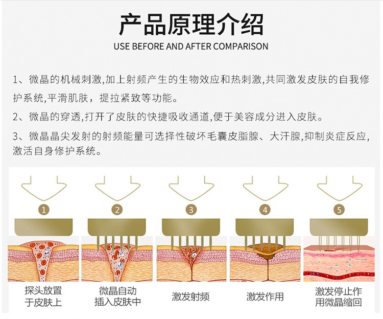 韩国黄金射频微针 美容仪器 祛痘印产后修复 皱纹美白提拉
