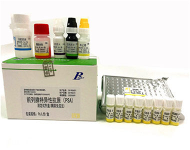 北方 前列腺特异性抗原测定试剂盒