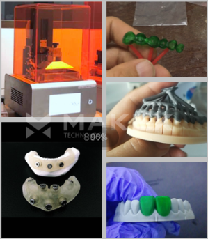 蜡冠3D打印机 牙科光固化蜡冠3D打印机