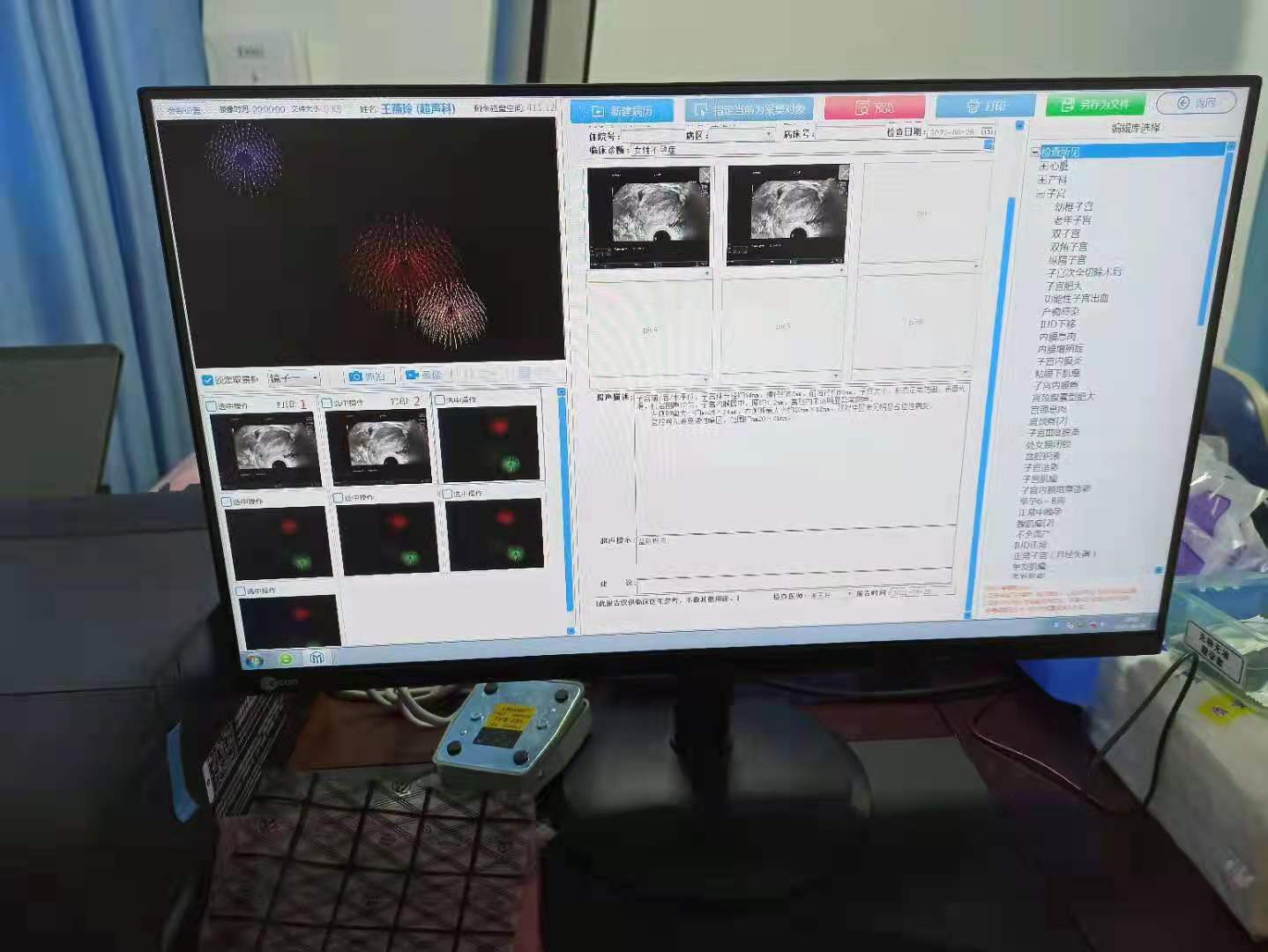 超声图文工作站（标清）