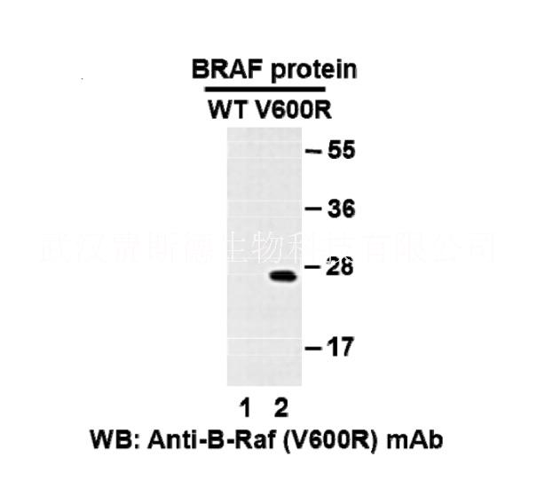 BRAF(V600R 小鼠单抗/Anti-BRaf(V600R Mouse Monoclonal Antibody